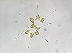 asterionella bf